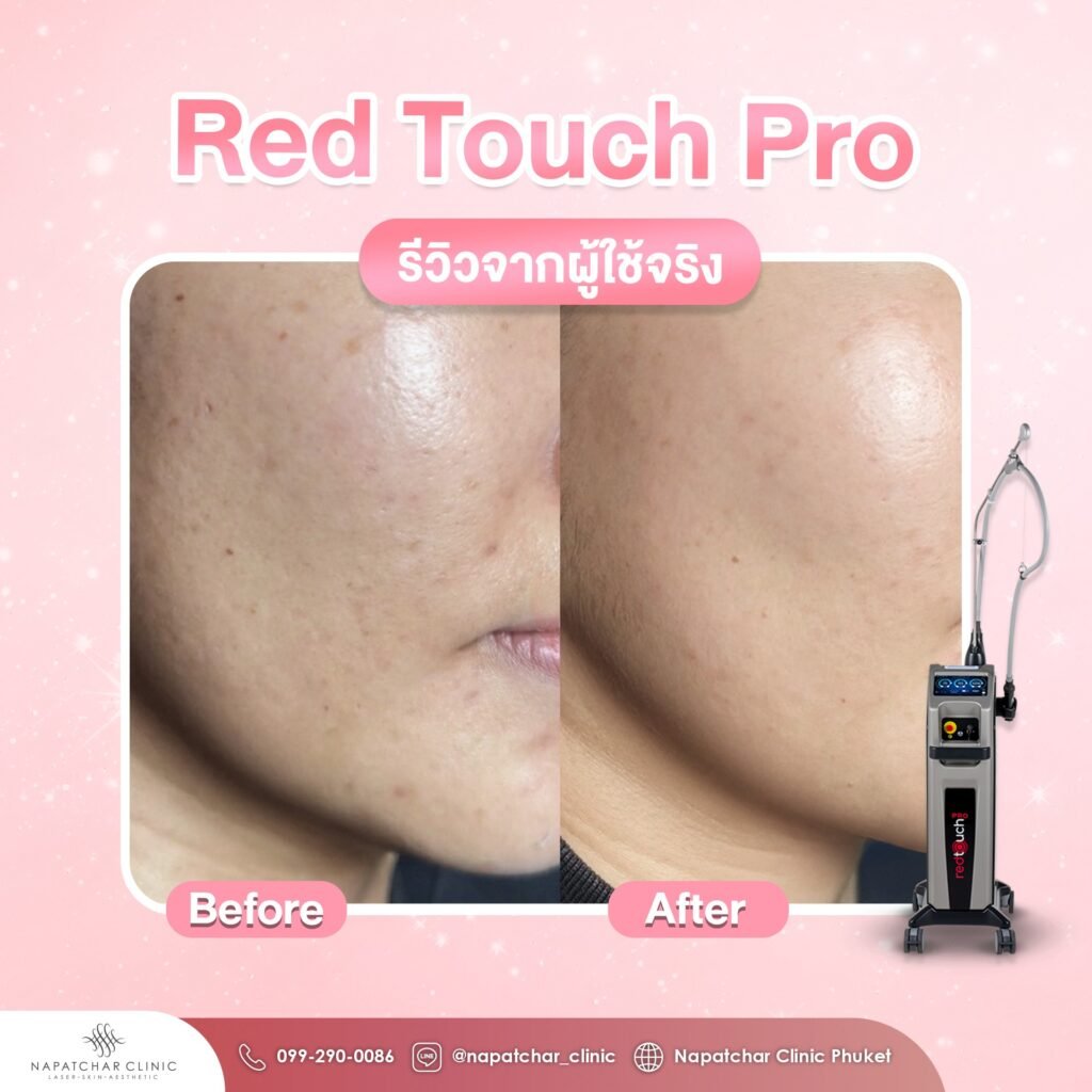 595336661_1326251219521702_4057233132179283285_n