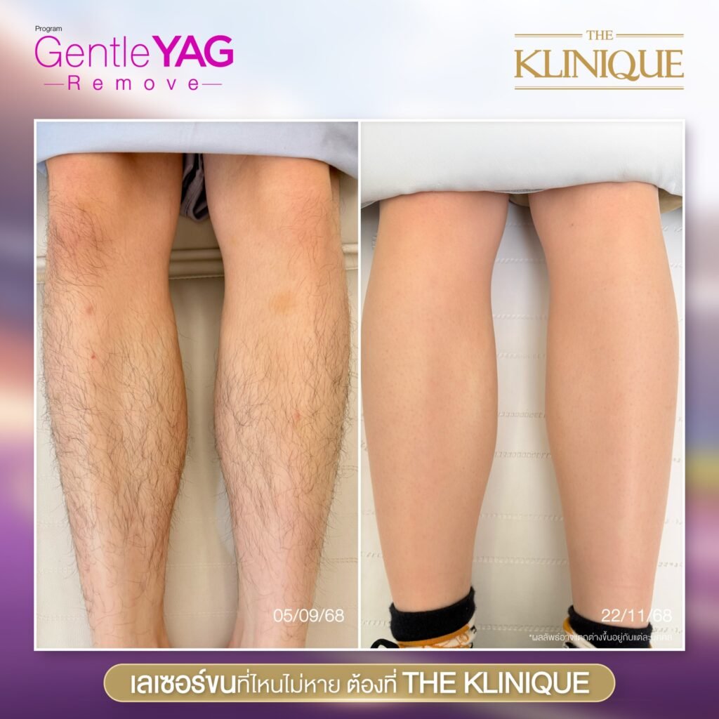 597776389_1279015504263429_2865304764426836908_n