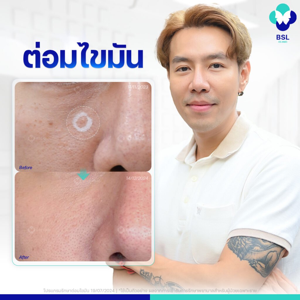 600406250_1318787193620677_2989077982416332152_n