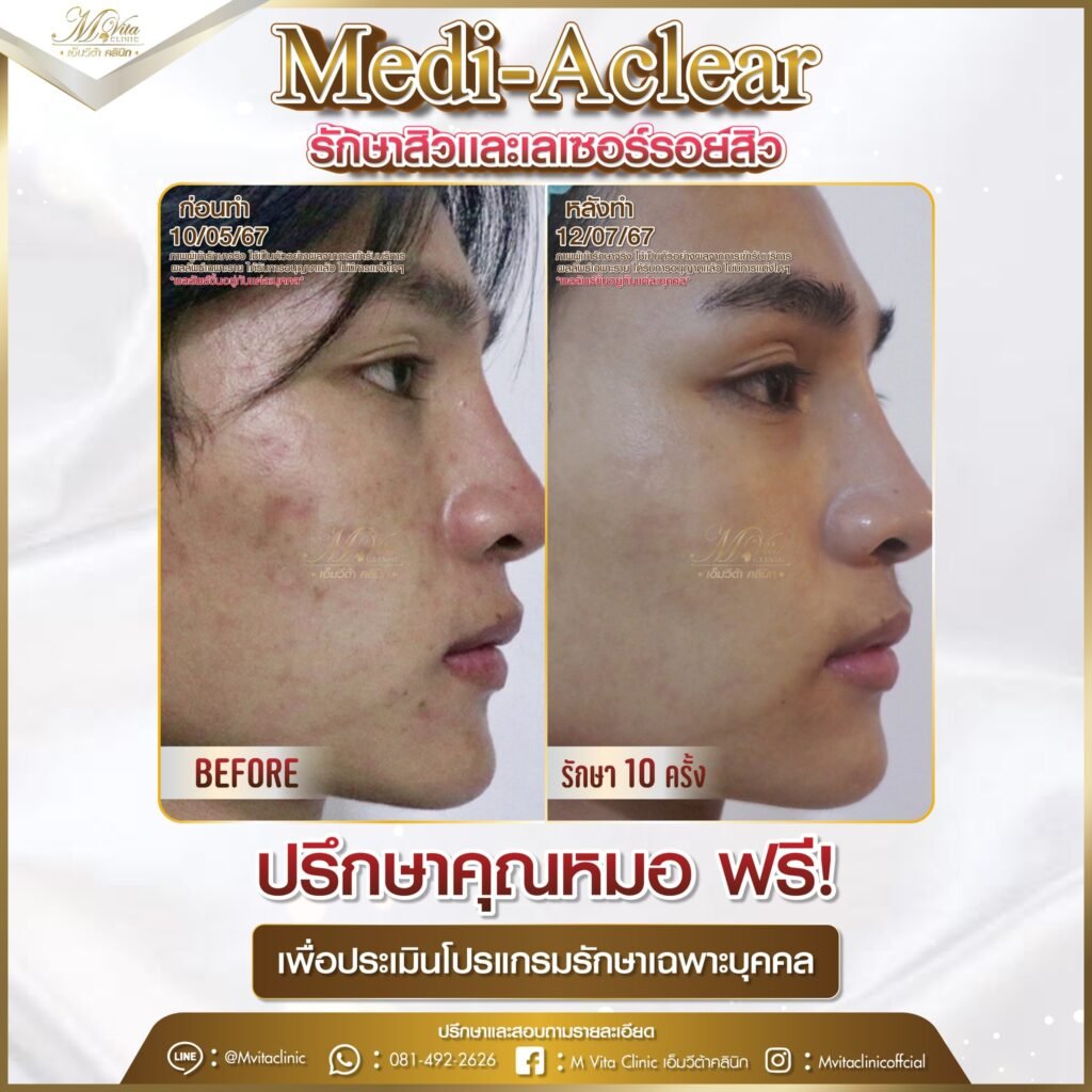 601822342_871537505255090_4634946598259240555_n