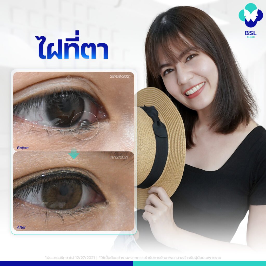 601823308_1318787190287344_4981767453525516580_n