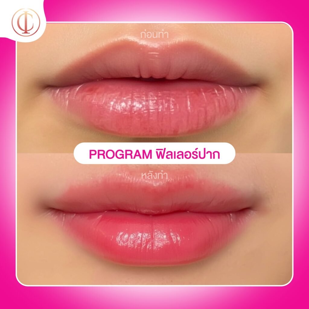 603961412_823590660505486_8613513095015946647_n