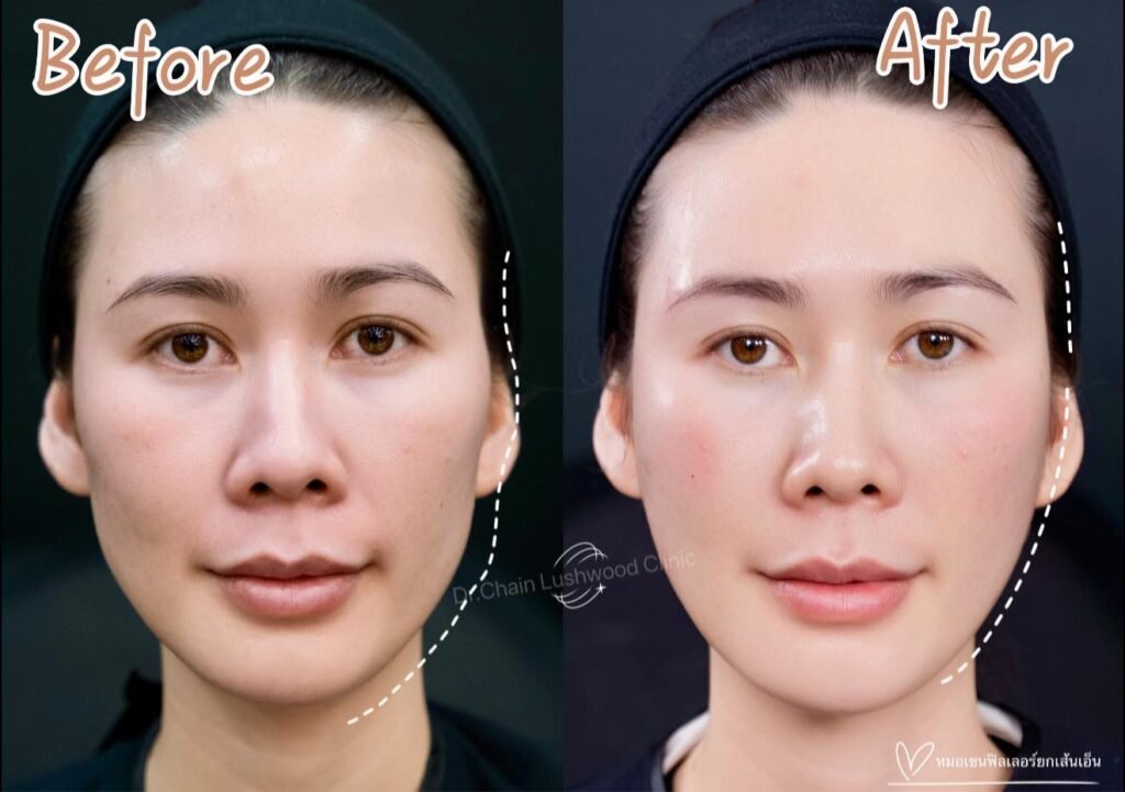 604568637_865958602891388_2656185663235704080_n