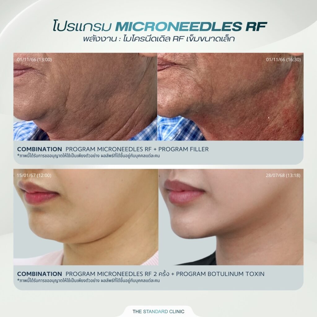 610125531_17957336106044343_8642081451249006717_n