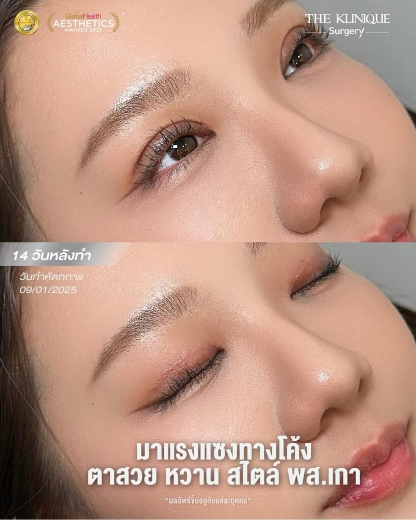 610287245_18554781349062879_7063916149916334061_n