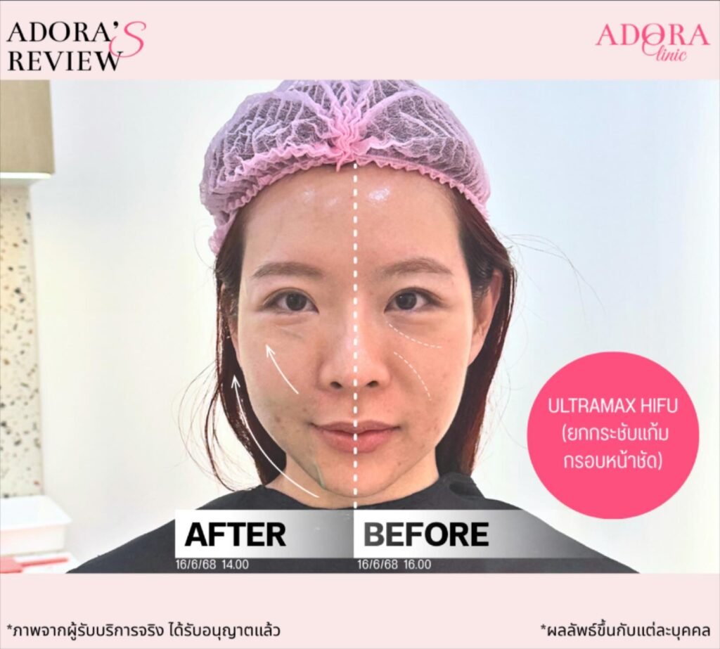 610664136_18003644300841992_2620433327675828265_n