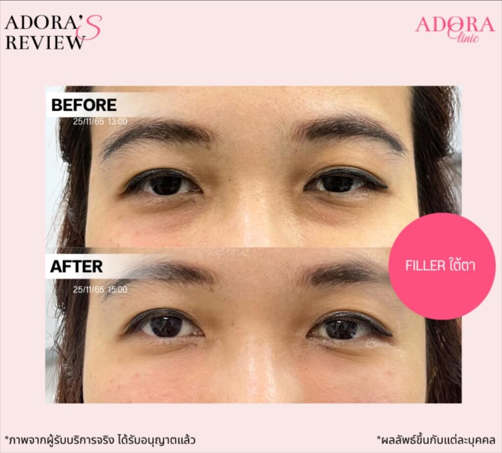 611279394_18003732518841992_6168584537351972151_n