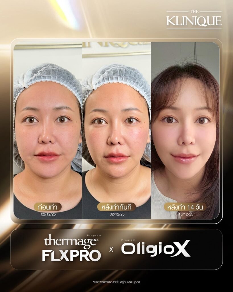 611593683_1294260766072236_5924077540216282013_n