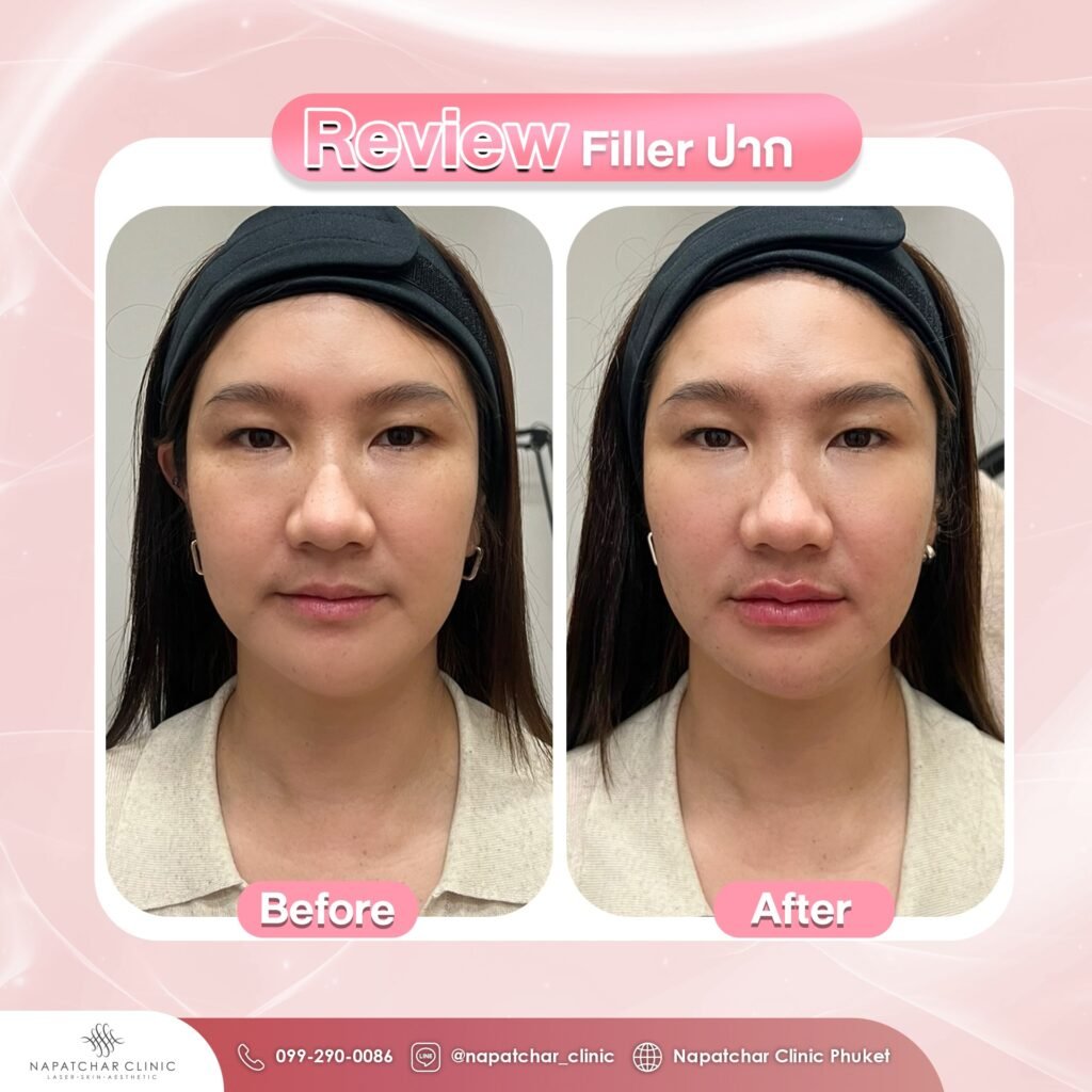 612429943_1351400677006756_7896185682784425936_n