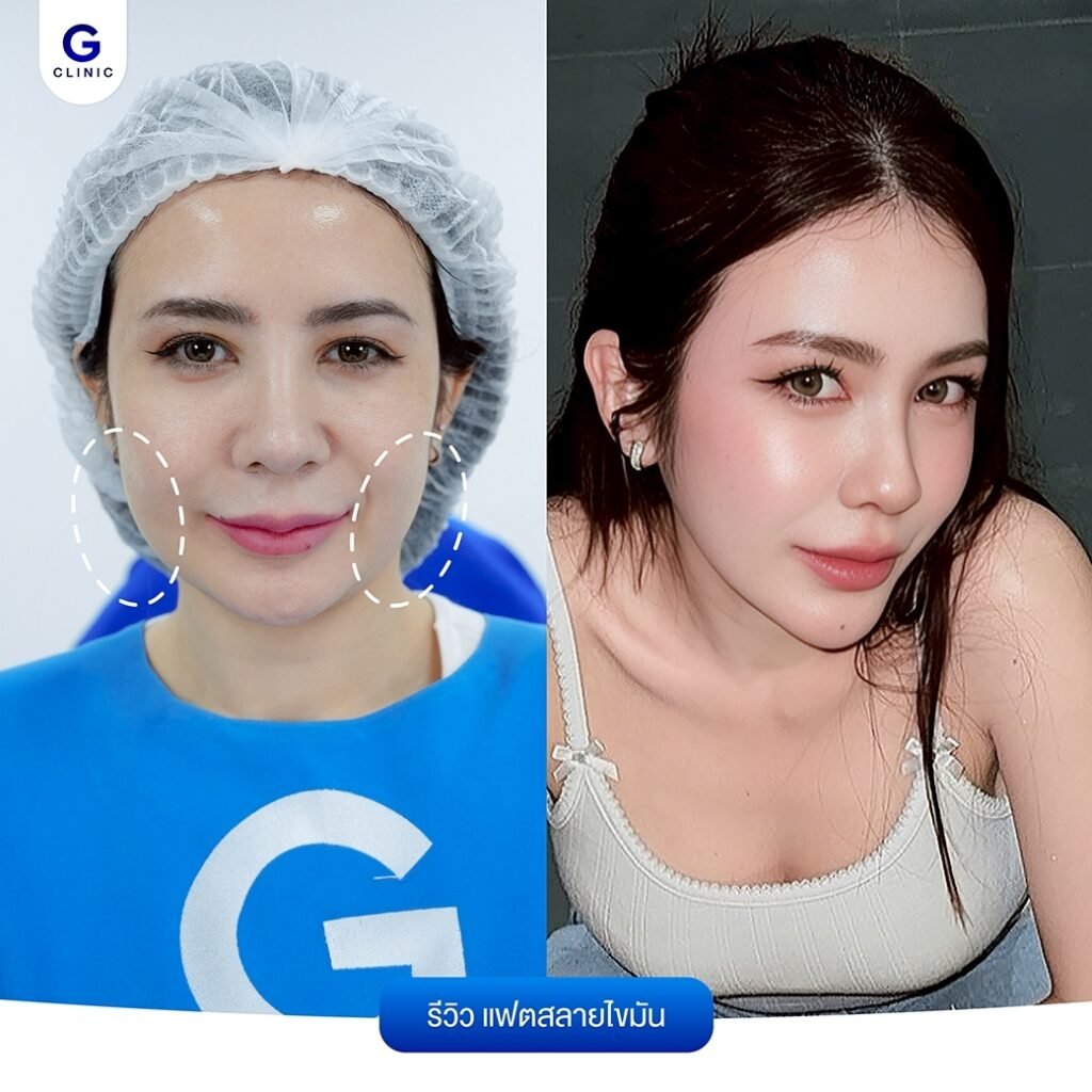 612591718_1192414899672379_4918908152953920593_n