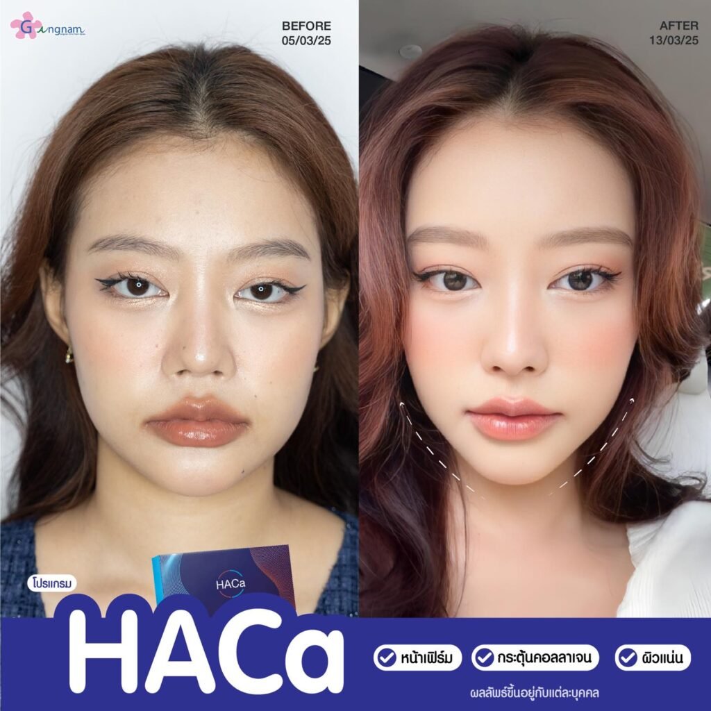 613138310_1474677117557727_8952963947572543026_n