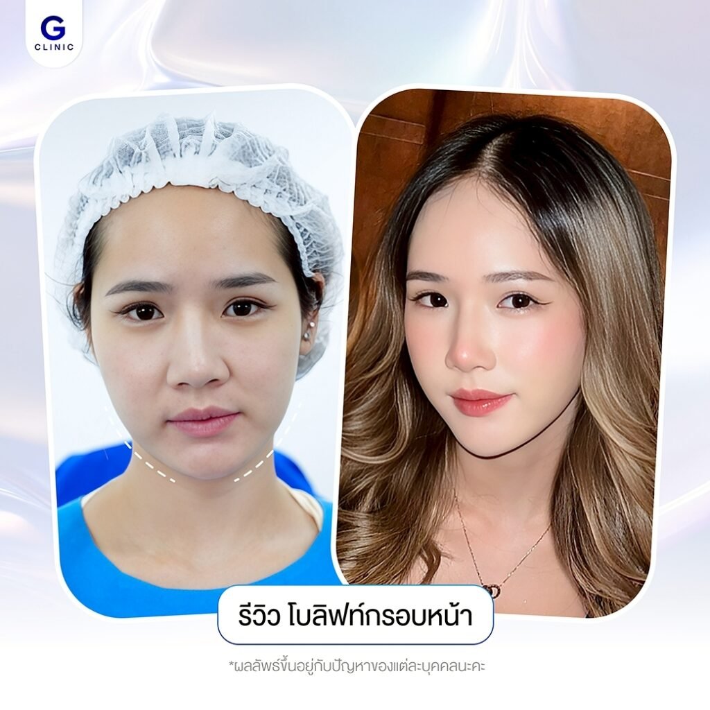 614628758_1195135499400319_1530771252194433754_n