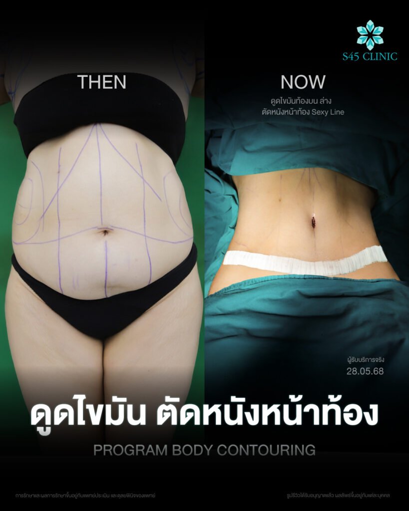 614649039_1279396154223748_704143941258673101_n