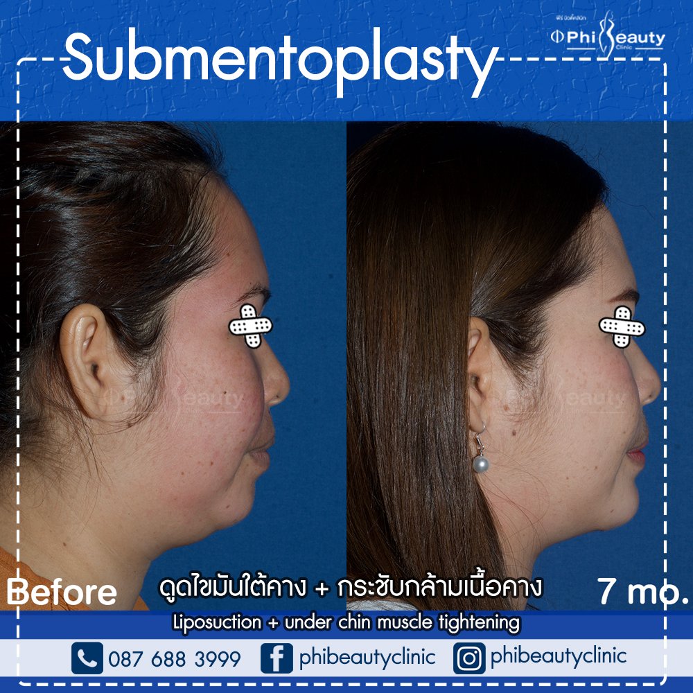 618721392_1327995082692293_6569023361676545639_n