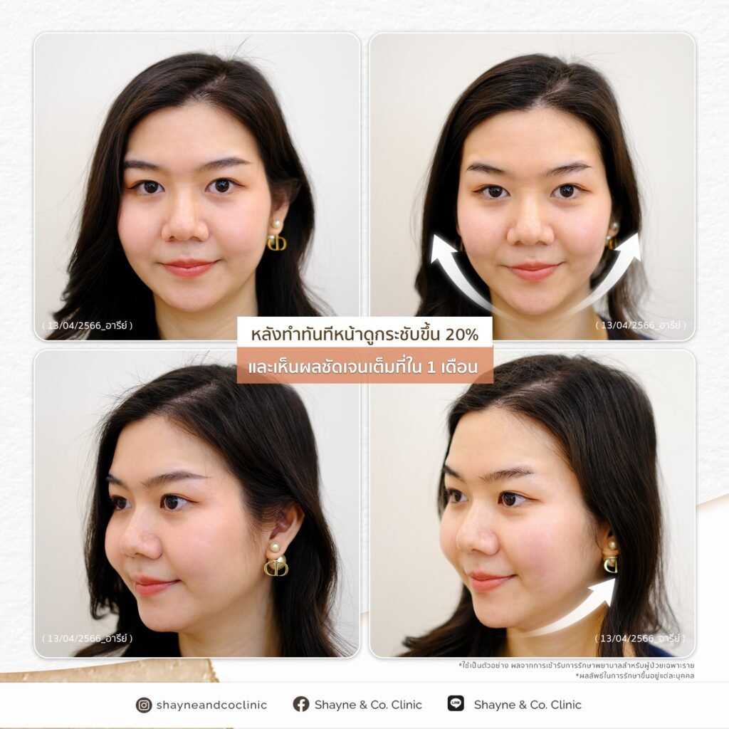 482249055_1013253157520073_4029767463873259_n