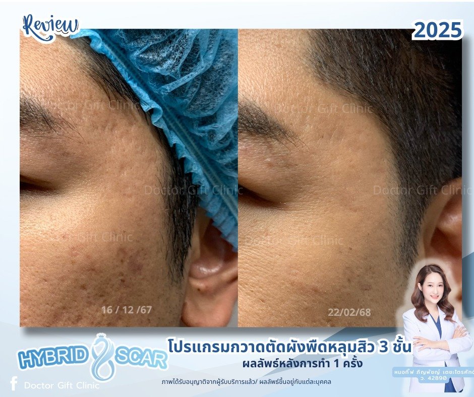 493225599_1503762790940651_4870232350073183064_n