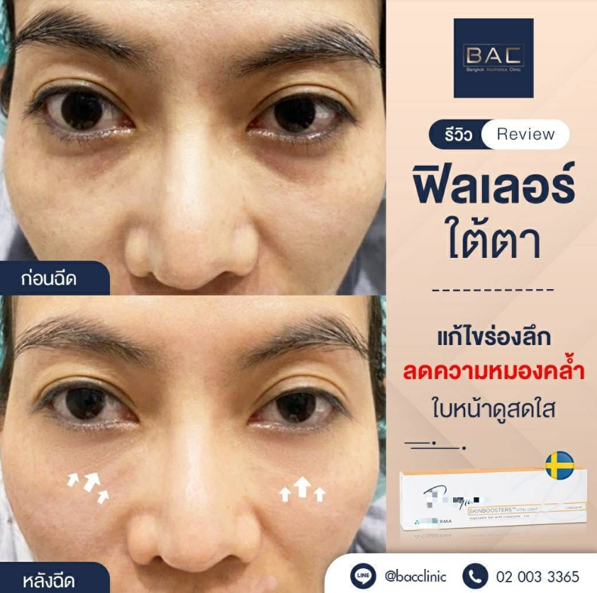 Bangkok Aesthetic Clinic 7