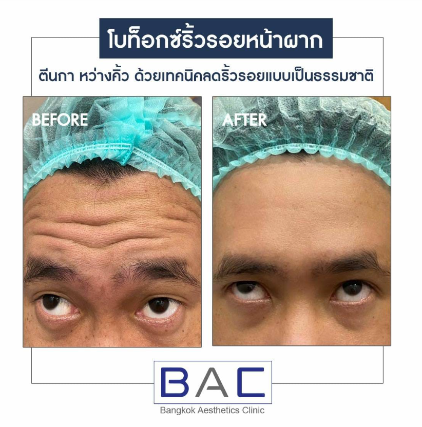 Bangkok Aesthetic Clinic 9