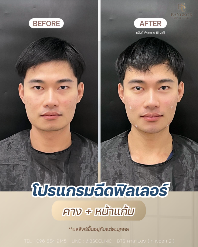 Bangkok Smart Clinic Beyond Wellness 10