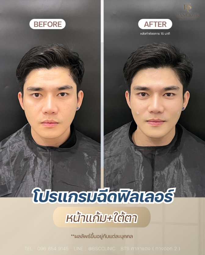 Bangkok Smart Clinic Beyond Wellness 6