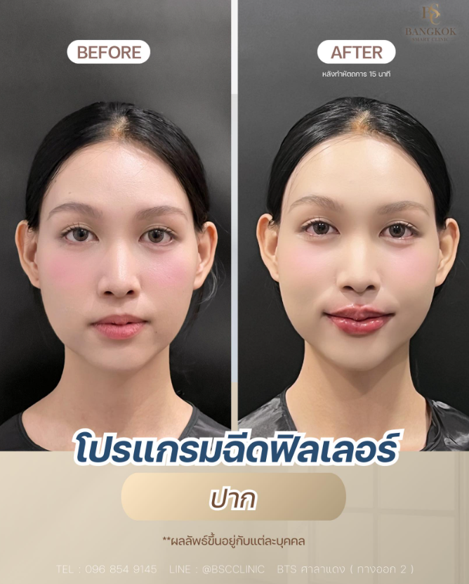 Bangkok Smart Clinic Beyond Wellness 7