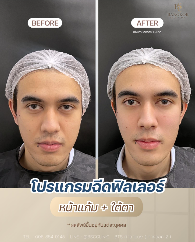 Bangkok Smart Clinic Beyond Wellness 8