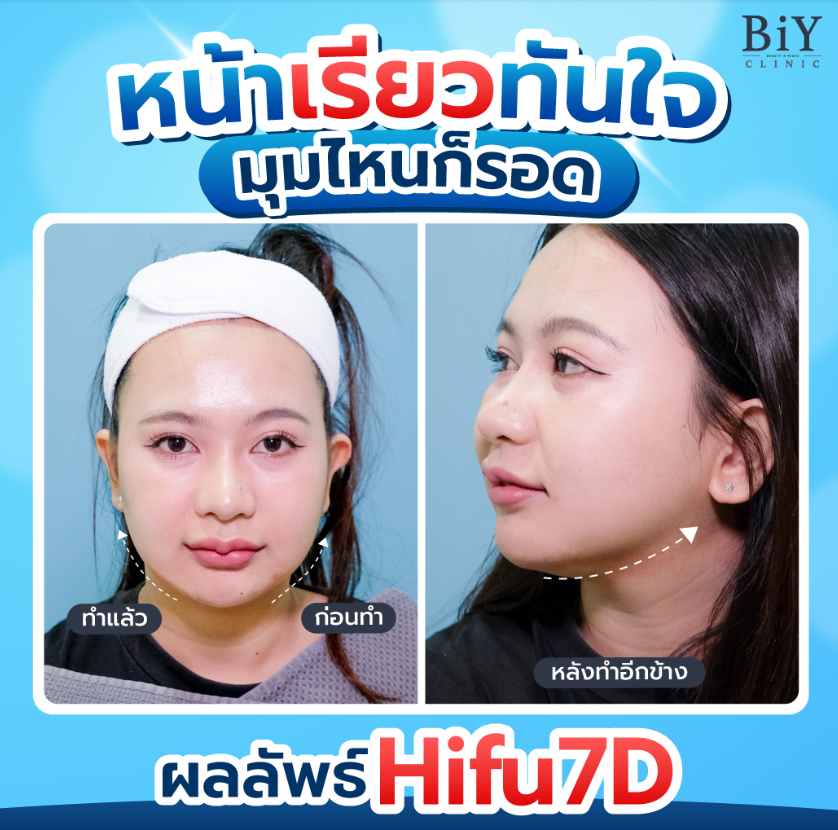 BiY Clinic before and after 1