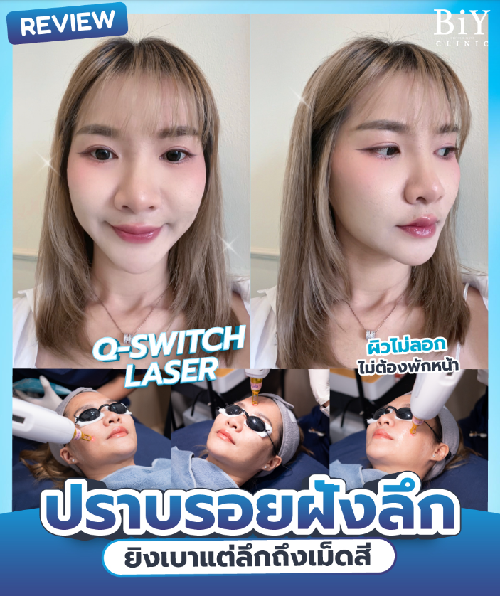 BiY Clinic before and after 2