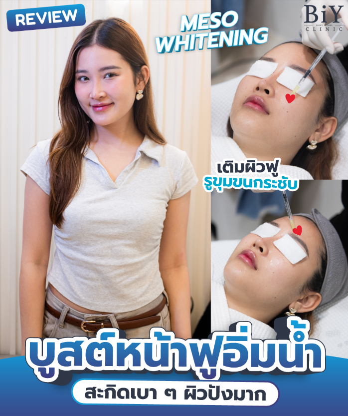 BiY Clinic before and after 3