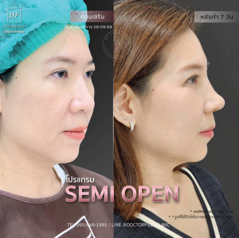 Doctor Fills Clinic 6