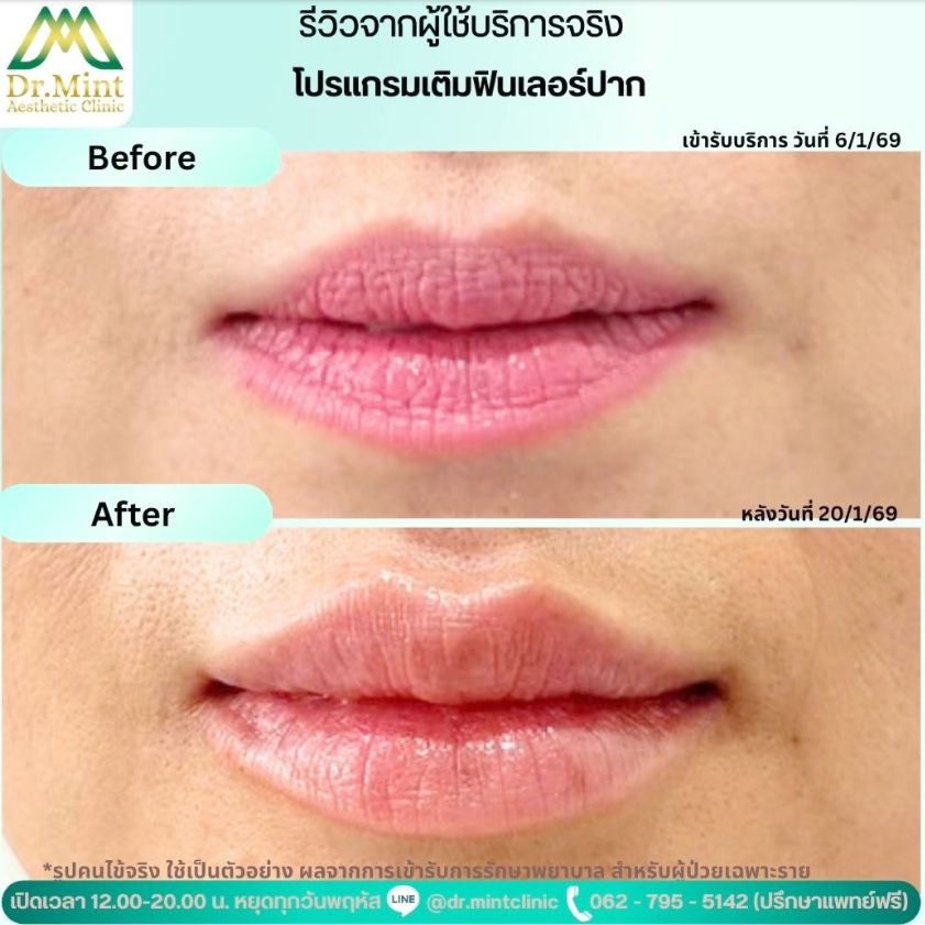 Dr. Mint Aesthetic Clinic 6