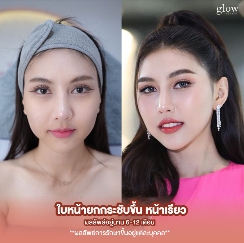 Glow Clinic 6