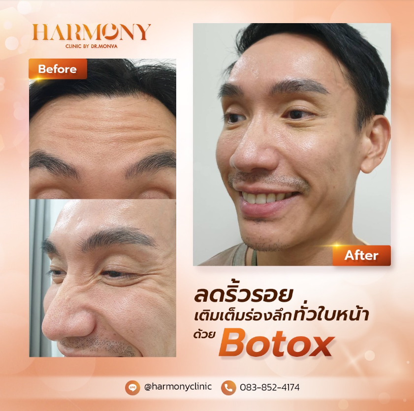 Harmony Clinic before and after 5