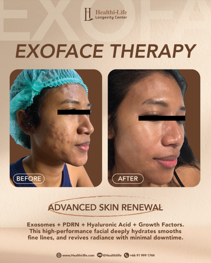 Healthi Life Thailand 7