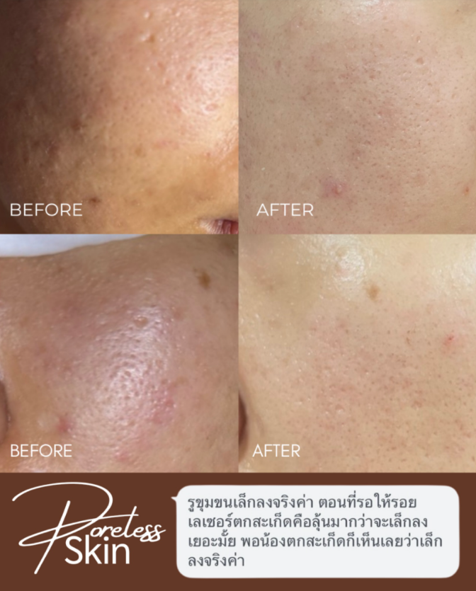 ISS Aesthetic & Wellness 3