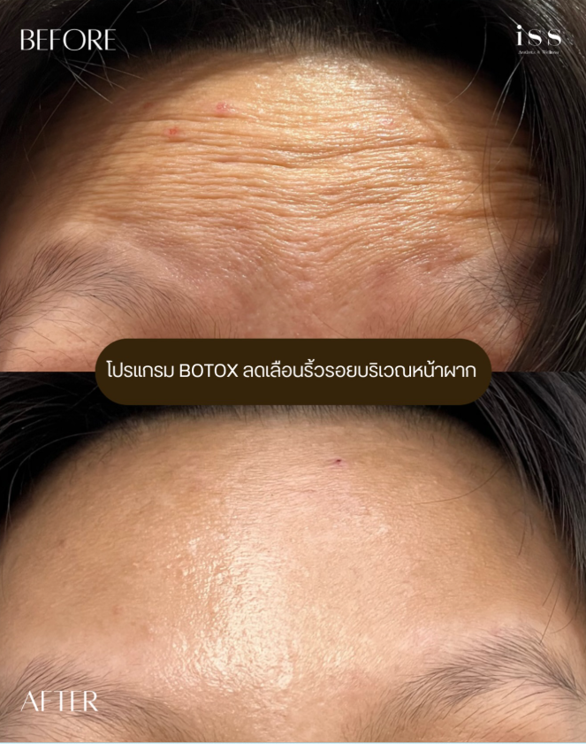 ISS Aesthetic & Wellness 4