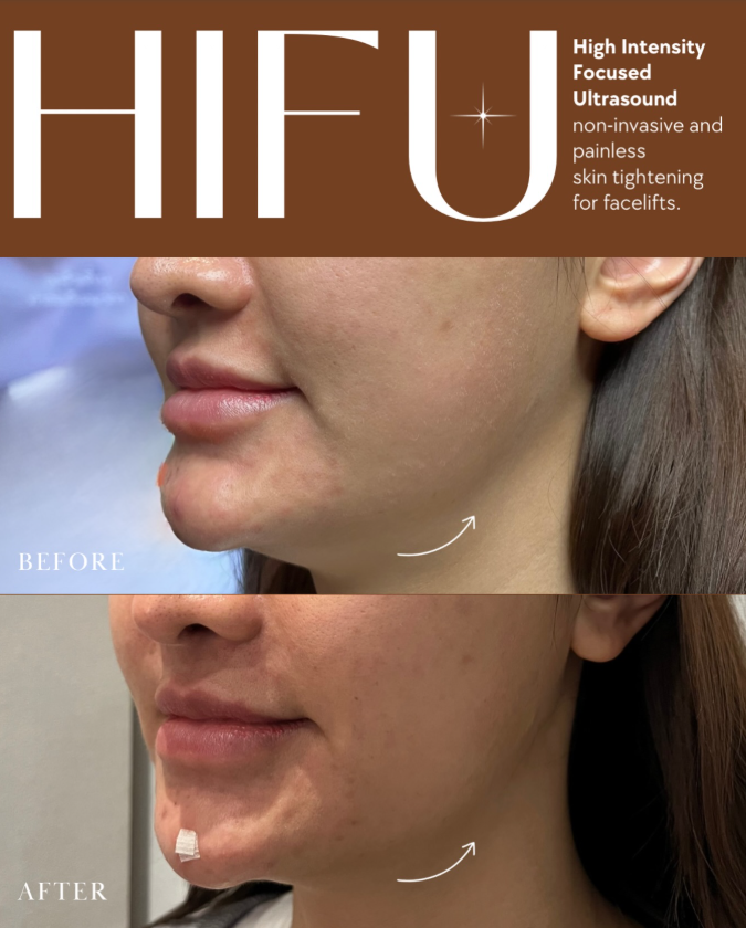 ISS Aesthetic & Wellness 5