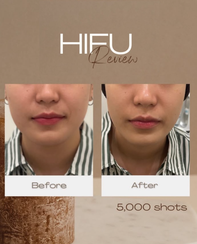 ISS Aesthetic & Wellness 6