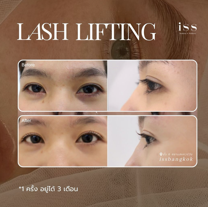 ISS Aesthetic & Wellness 7