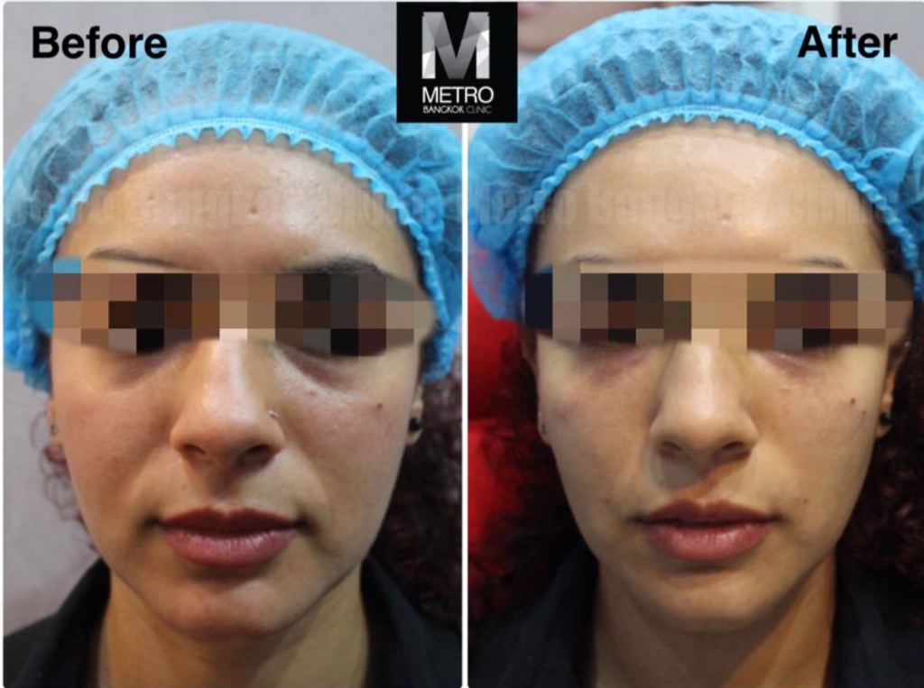 Metro Bangkok Clinic 4