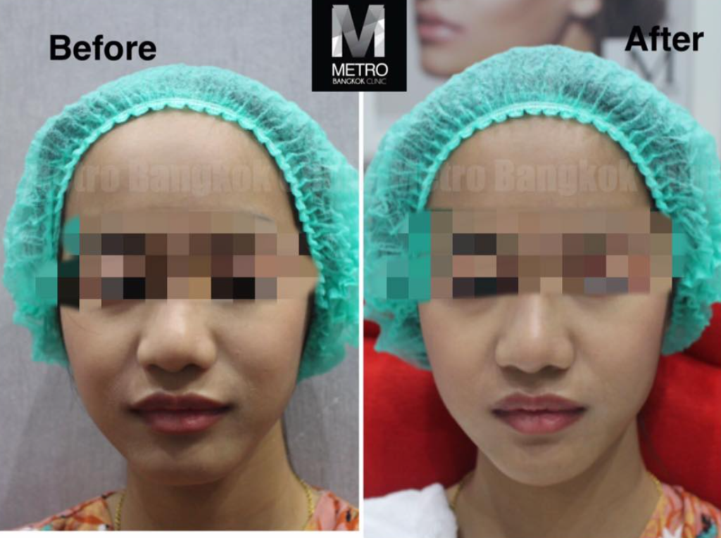 Metro Bangkok Clinic 5