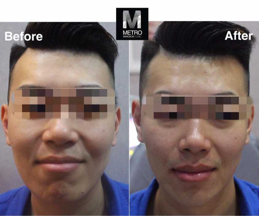 Metro Bangkok Clinic 6