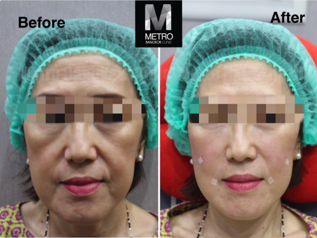 Metro Bangkok Clinic 7