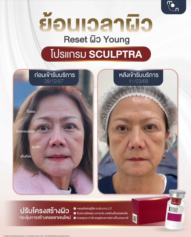 Million Moon Clinic 6