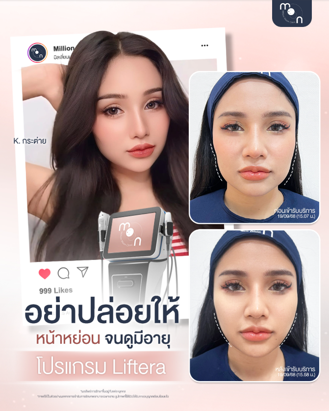 Million Moon Clinic 7