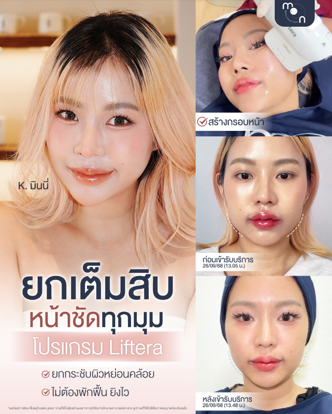 Million Moon Clinic 8