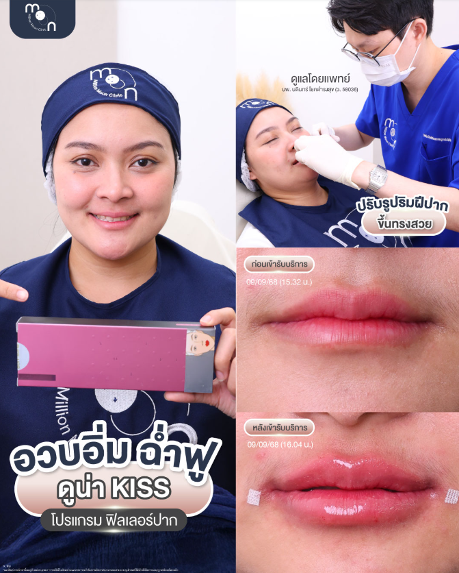 Million Moon Clinic 9