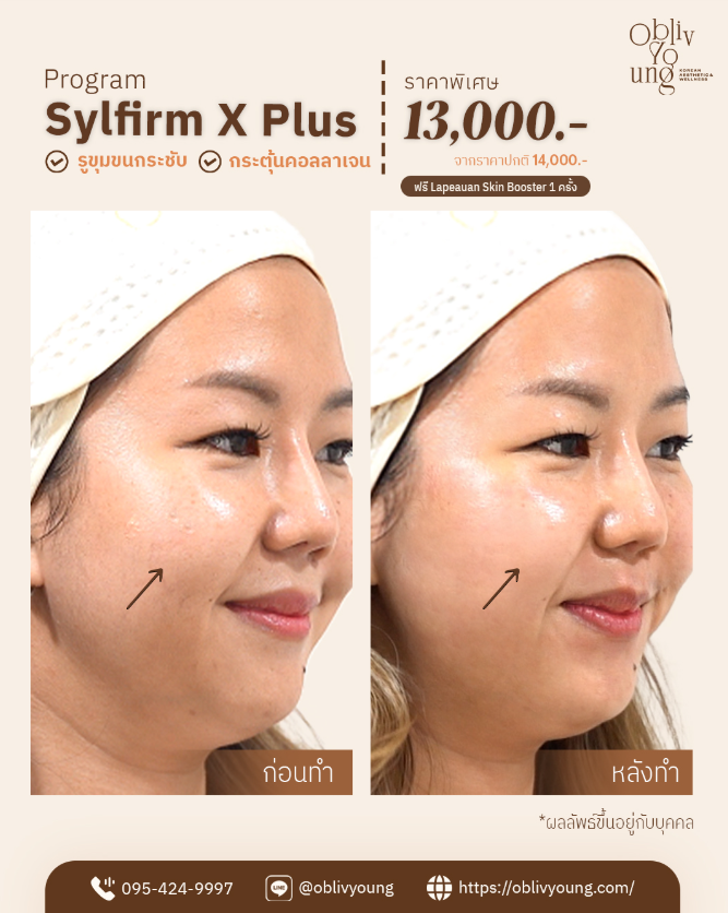 Obliv Young Clinic 10