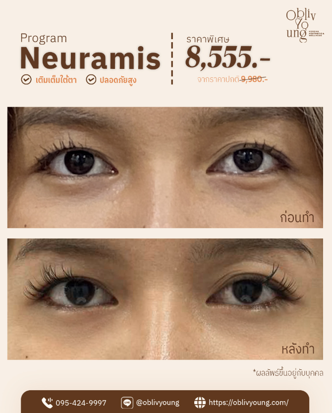 Obliv Young Clinic 8