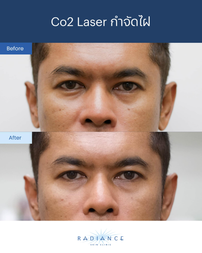 Radiance Clinic Before and After 4